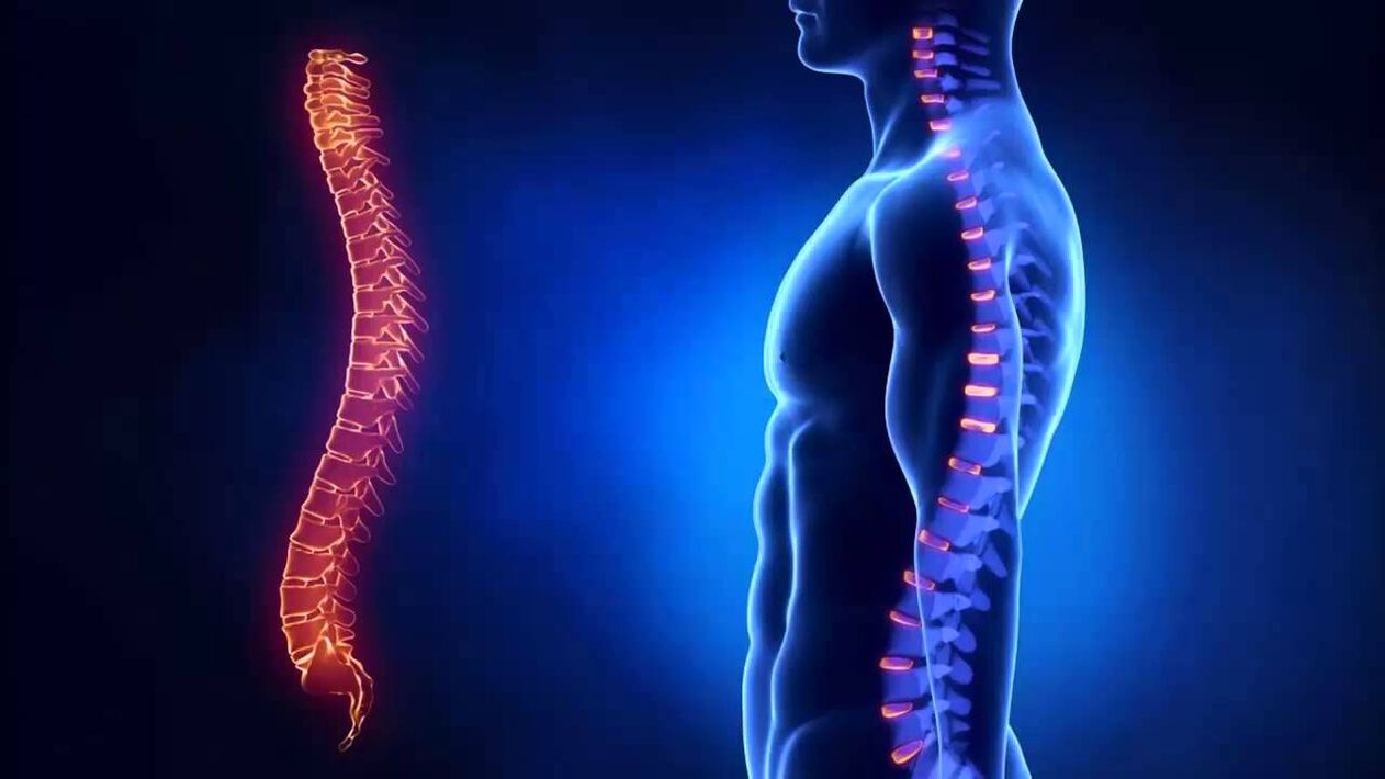 Osteochondrosis is classified based on where in the spine the disease occurs.
